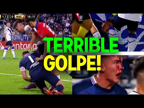 VELEZ VS NACIONAL SERGIO ROCHET ACABÓ CON EL ROSTRO ENSANGRENTADO TRAS UN DURO GOLPE