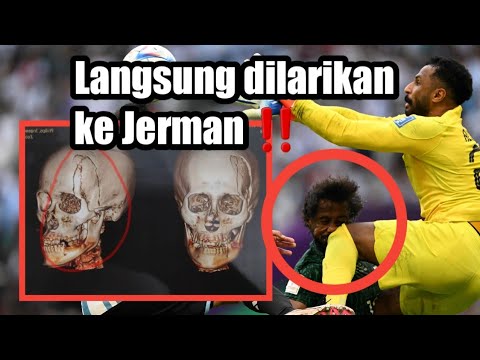 DETIK-DETIK PEMAIN ARAB SAUDI MENGALAMI BENTURAN MENGERIKAN ❗️