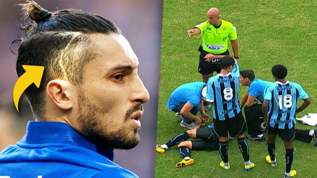 Dlaczego Alex Telles ma blizny na głowie? Dlaczego Alex Telles ma blizny na głowie?