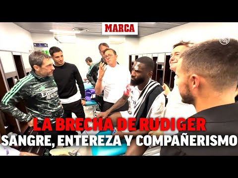 Así trataron la brecha de Rudiger en el vestuario: sangre, entereza y mucho compañerismo I MARCA