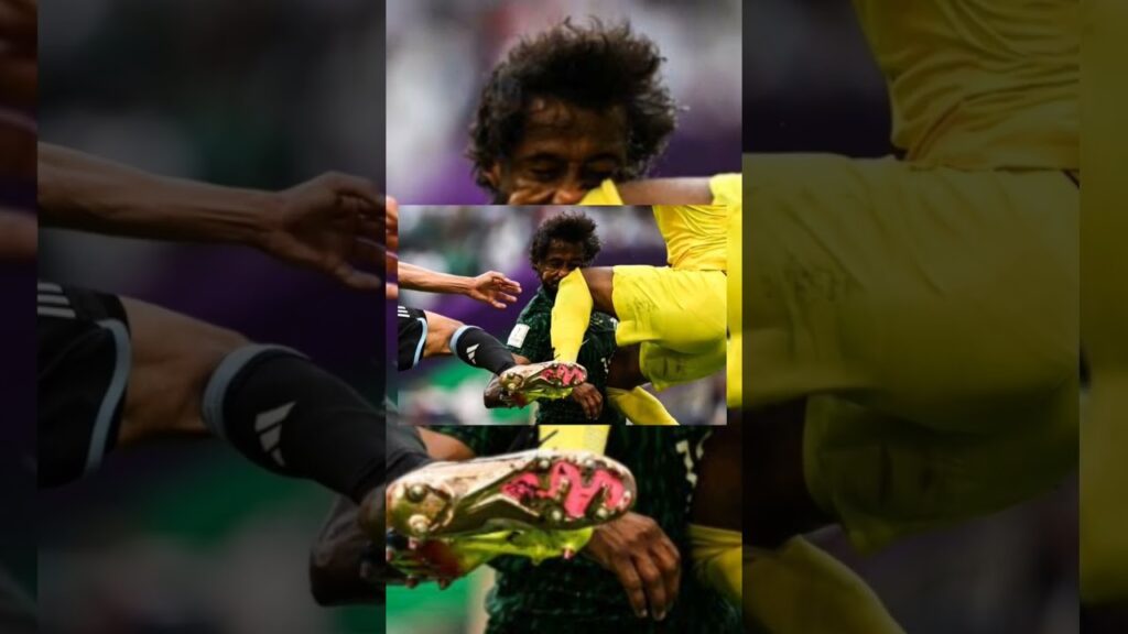 মুখের হাড় ভেঙে গেছে সৌদি ফুটবলার ইয়াসিরের 😭 Yasser Al shahrani | Qatar World Cup