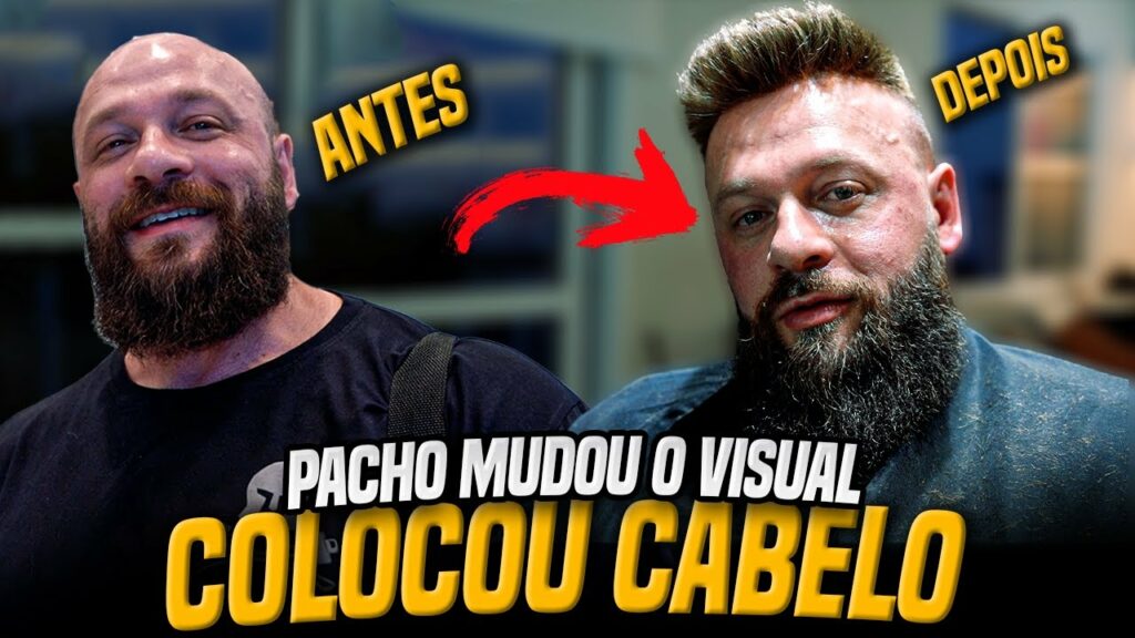 PACHO MUDOU O VISUAL! COLOCOU CABELO!