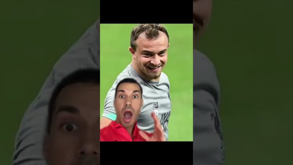 Shaqiri before & after #shaqiri #albania #liverpool #switzerland #hair #hairline #hairtransplant