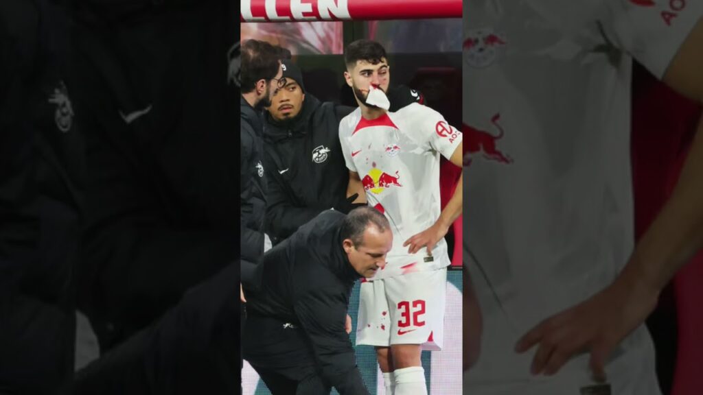 ¿POR QUÉ JOSKO GVARDIOL JUGO con una MASCARA en QATAR 2022? ¿POR QUÉ JOSKO GVARDIOL JUGO con una MASCARA en QATAR 2022?