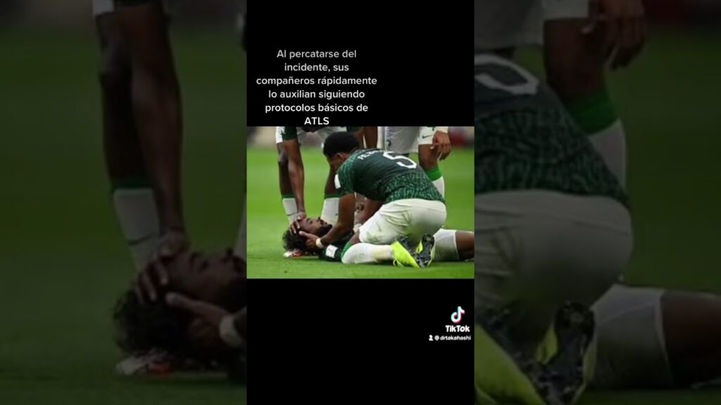 Trauma facial en el mundial