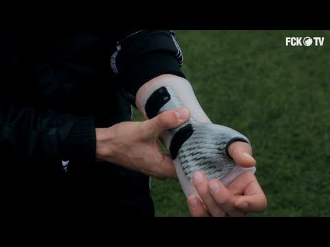 Delaney spiller med brækket hånd