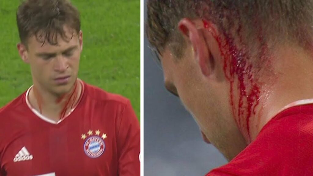 Wie geht es Joshua Kimmich?