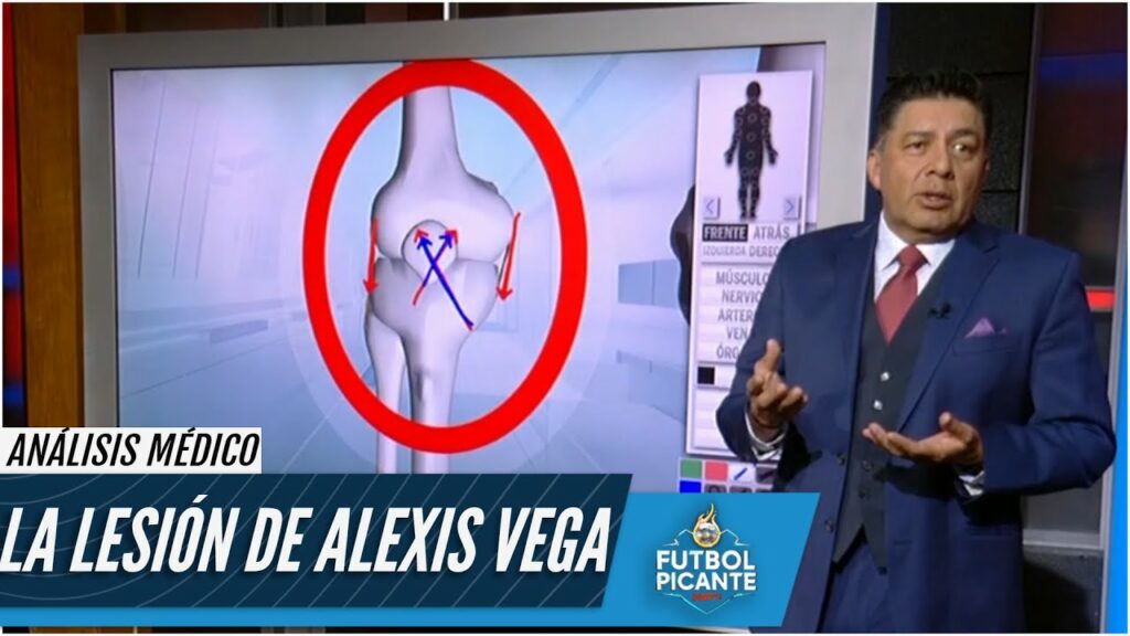 TERROR EN CHIVAS. Alexis Vega SERÁ OPERADO y estará fuera de 4 a 8 semanas | Futbol Picante