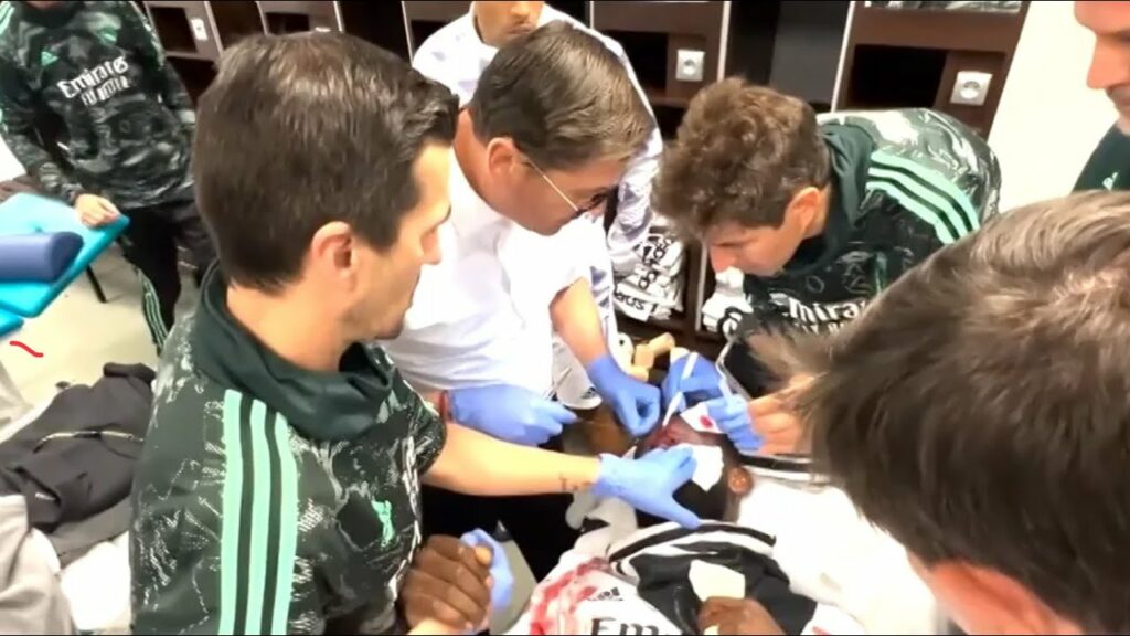 Antonio Rüdiger müsste in der Kabine genäht werden 🪡 nach Horror Verletzung 😔