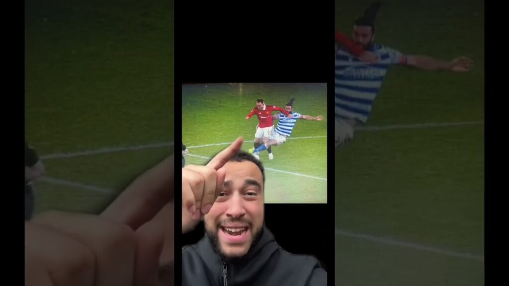 Christian eriksen assault leaves him in crutches 🫣🩼 (ex Liverpool Andy carroll tackle vs Man Utd)