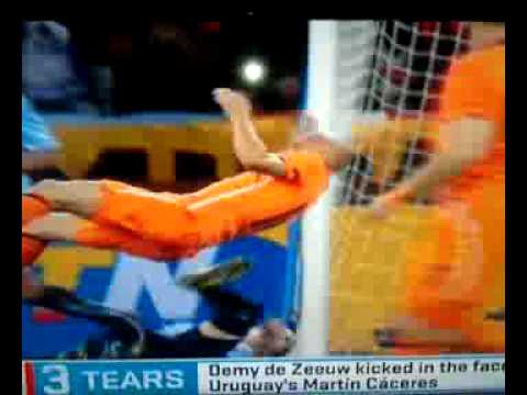 Uruguay's Martin Caceres kicked in face soccer fail