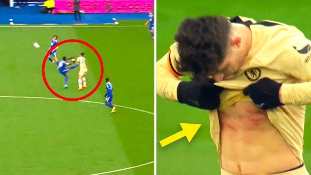 🔥😱 Not even a yellow! Stud marks on Havertz after brutal Amartey foul