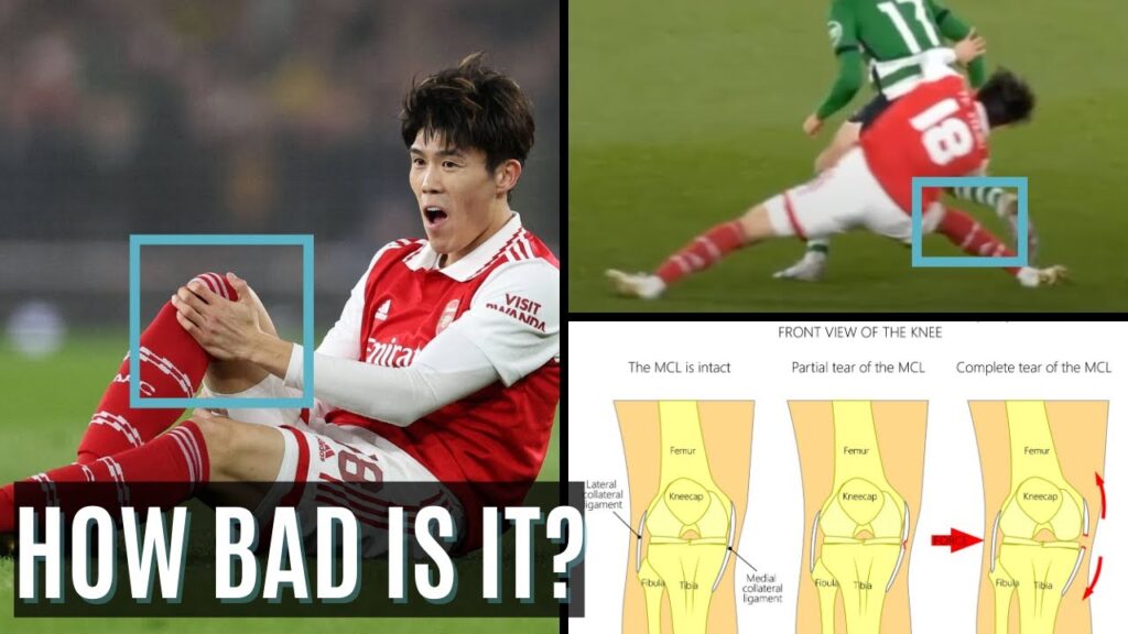 Expert Explains Takehiro Tomiyasu Knee Injury & Potential Timeline