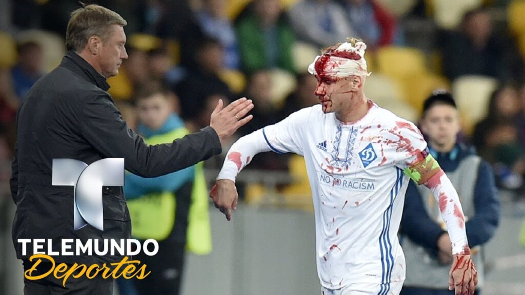 El interminable baño de sangre de Vida en plena cancha | Videos Virales | Telemundo Deportes