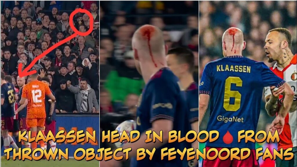 KLAASSEN HEAD IN BLOOD🩸FROM THROWN OBJECT BY FEYENOORD FANS DURINH AJAX VS FEYENOORD CLASH 🤕
