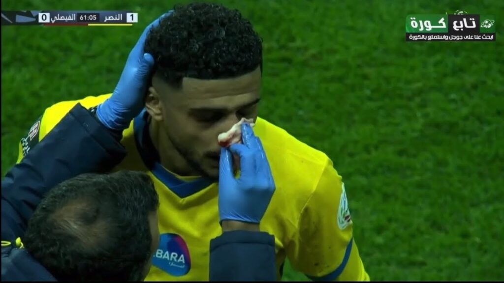 إصابة عبدالإله العمري في مباراة النصر والفيصلي