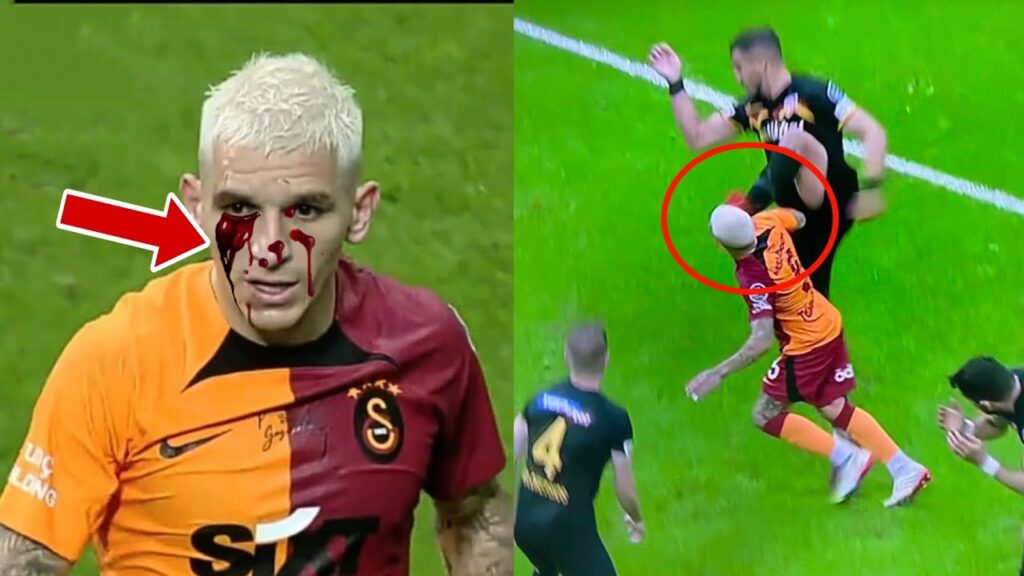 Lucas Torreira INJURY Vs Kayserispor