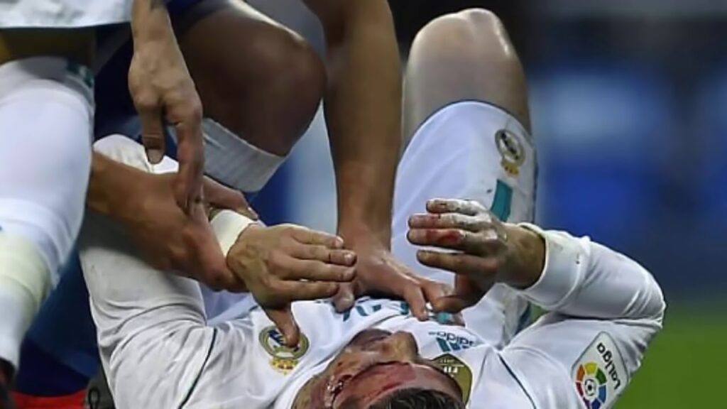 Cristiano Ronaldo received a nasty kick to the face from Fabian Schar in scoring his second