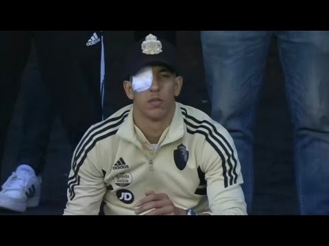 تفاصيل نقل جواد الياميق إلى المستشفى في حالة استعجالية بعد أن فقد البصر في إحدى عينيه/ جواد الياميق😢