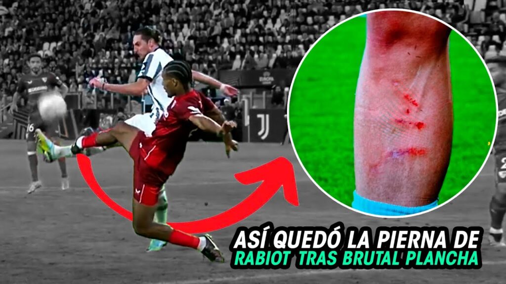Así QUEDÓ la PIERNA de RABIOT después de SUFRIR un CLARO PENAL que NO FUE PITADO para la JUVE