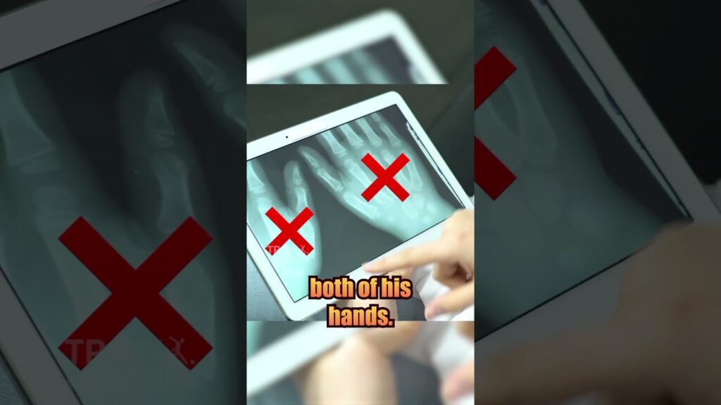 How Szczesny Almost Retired At Just 18 Years Old