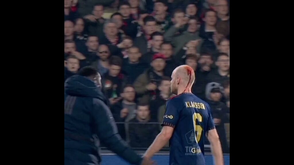 Crazy & Fiery Feyenoord Vs Ajax Atmosphere 😱🔥 | Davy Klaassen Left Bloodied By Object Thrown By Fan.