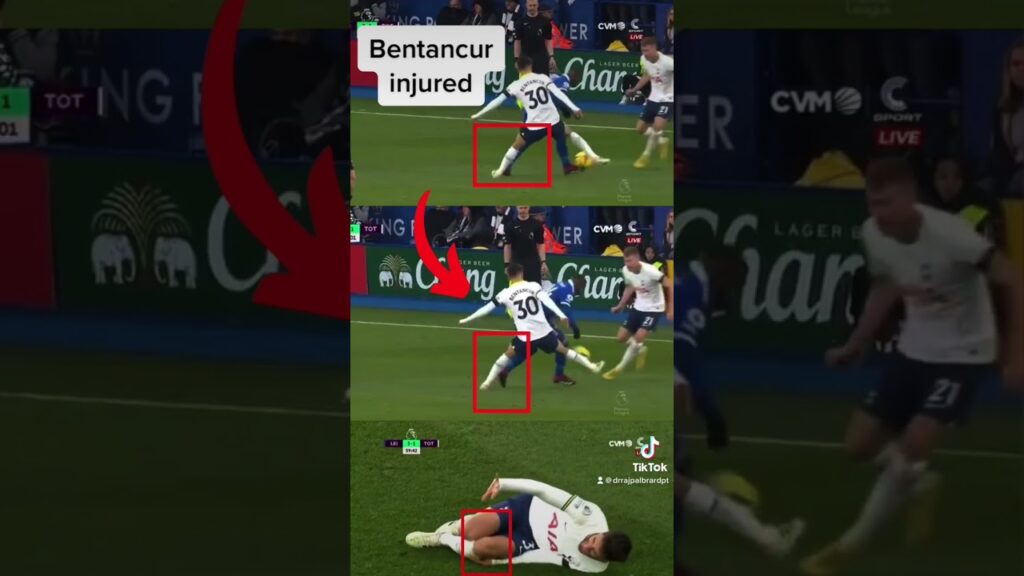 Rodrigo Bentancur injured. Expert explains | #thfc #tottenham #tottenhamhotspur #premierleague #epl