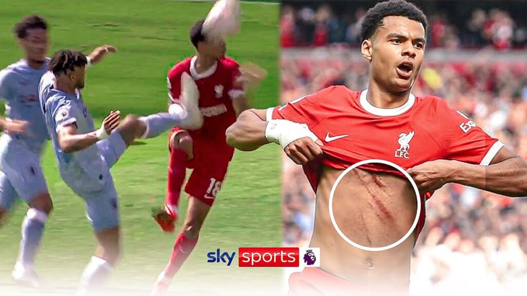 Why did Tyrone Mings escape red after high challenge on Cody Gakpo?