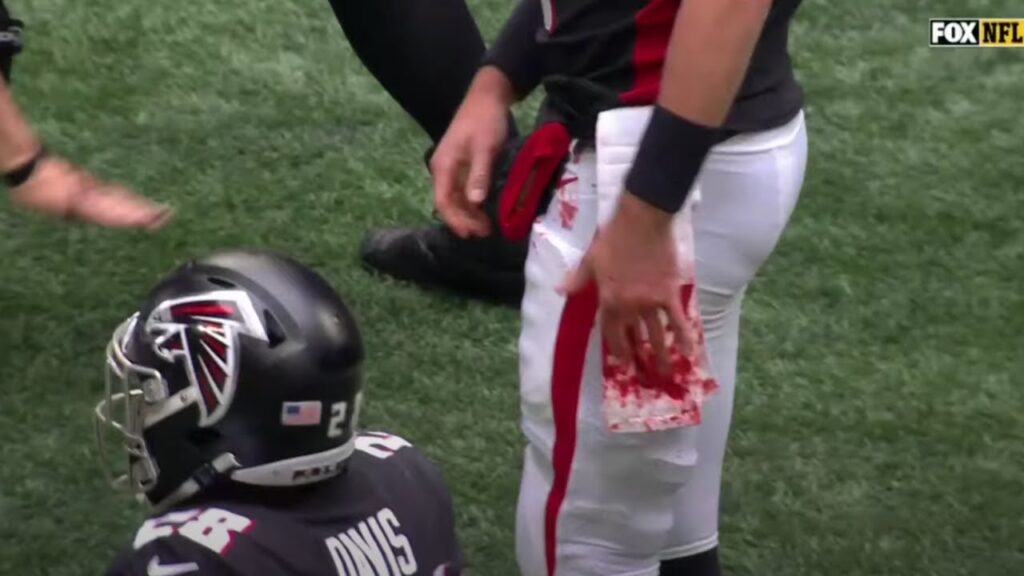 Matt Ryan bloody hand after getting cleated
