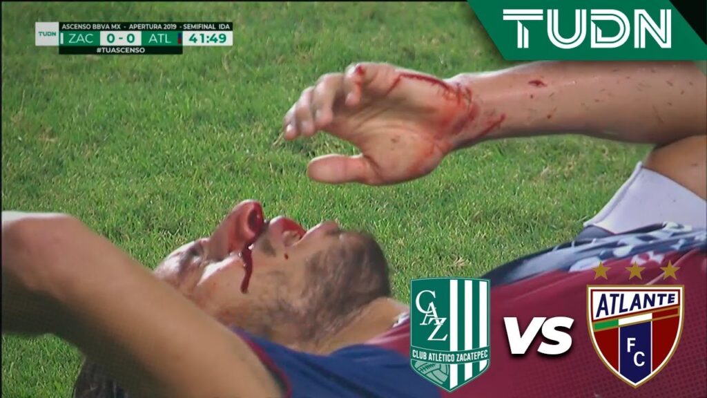 ¡Impactante lesión de Sosa!  | Zacatepec 0  - 0 Atlante | Ascenso MX - Semifinal Ida - AP 19 | TUDN