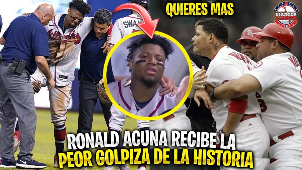 La vez que RONALD ACUÑA JR recibió la PEOR GOLPIZA de la HISTORIA | MLB