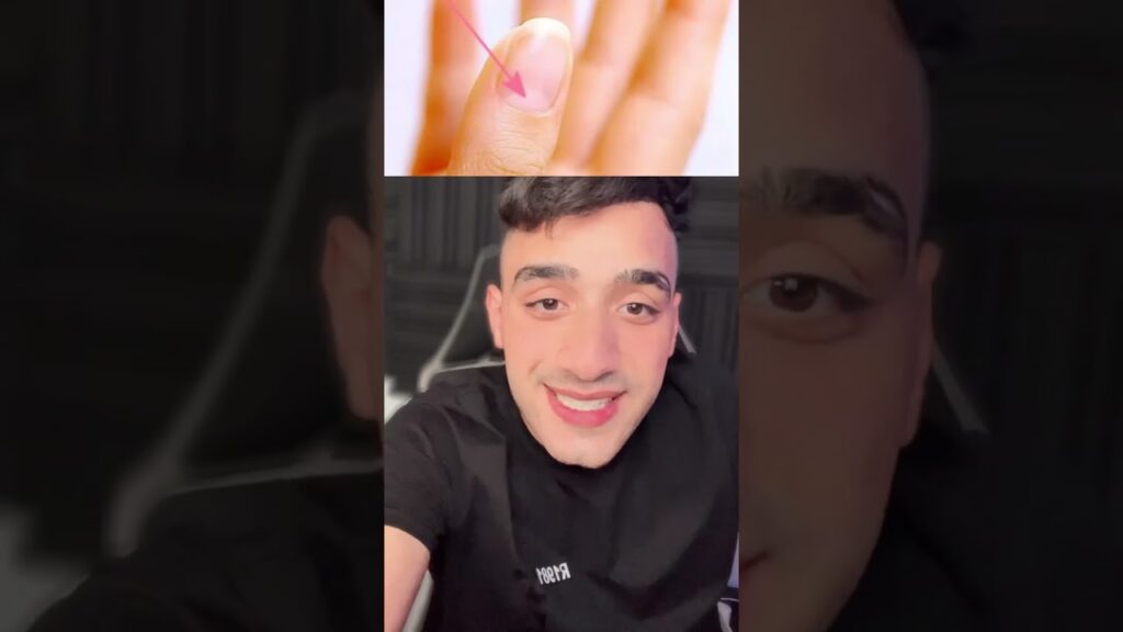 مسعود اوزيل كان يعلم هذول الاشخاص كيف يسددوا !؟ مستحيل