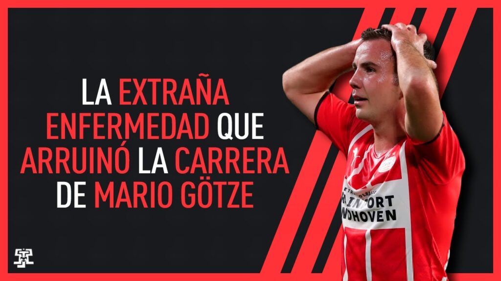 La EXTRAÑA ENFERMEDAD que ARRUINÓ la CARRERA de MARIO GOTZE