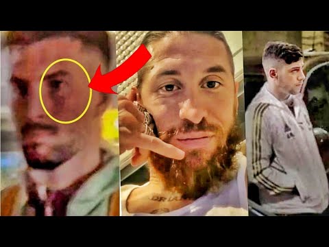 Football world reactions to Fed Valverde pu''''''''nching Baena face after he used bad words