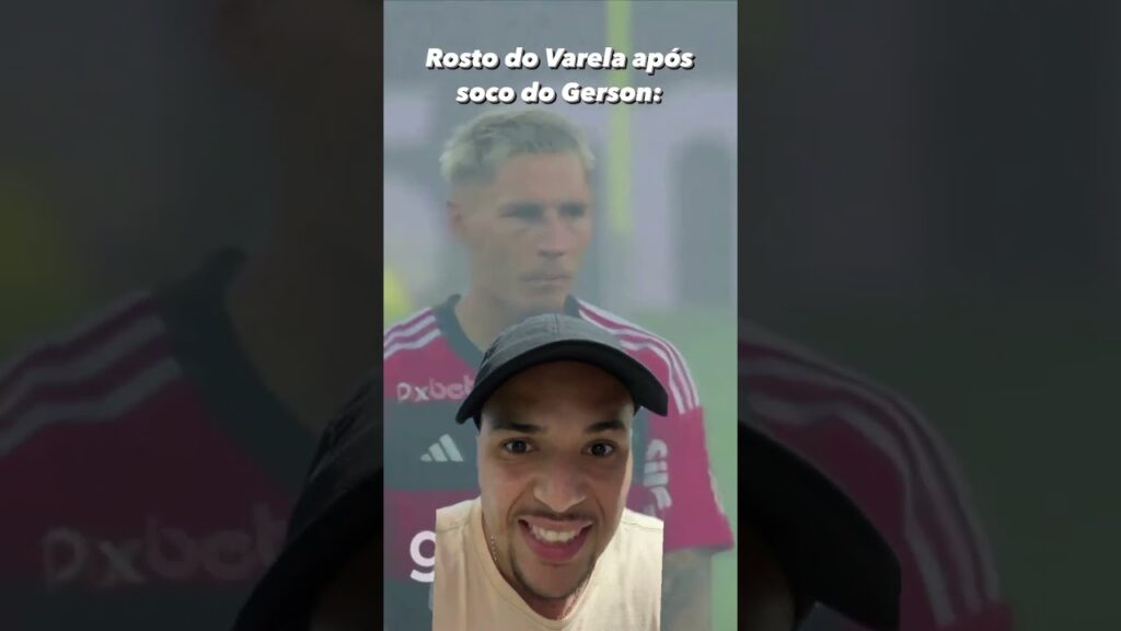 Olha como ficou o Rosto do Varela após soco do Gerson (Flamengo)