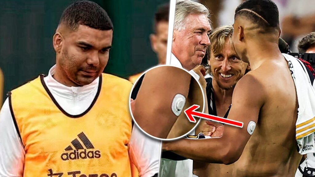 ¡El EXTRAÑO aparato que CASEMIRO tiene que USAR para JUGAR! ¡¿Está enfermo?!😨