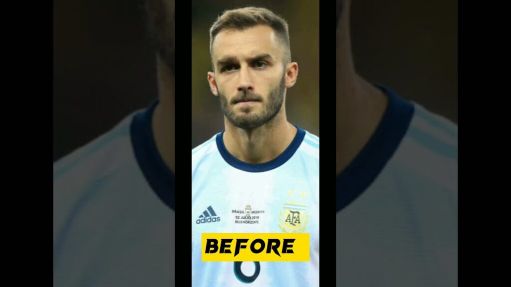 German Pezzella BEFORE And AFTER #youtubeshorts #beautifulphotos #shorts #football
