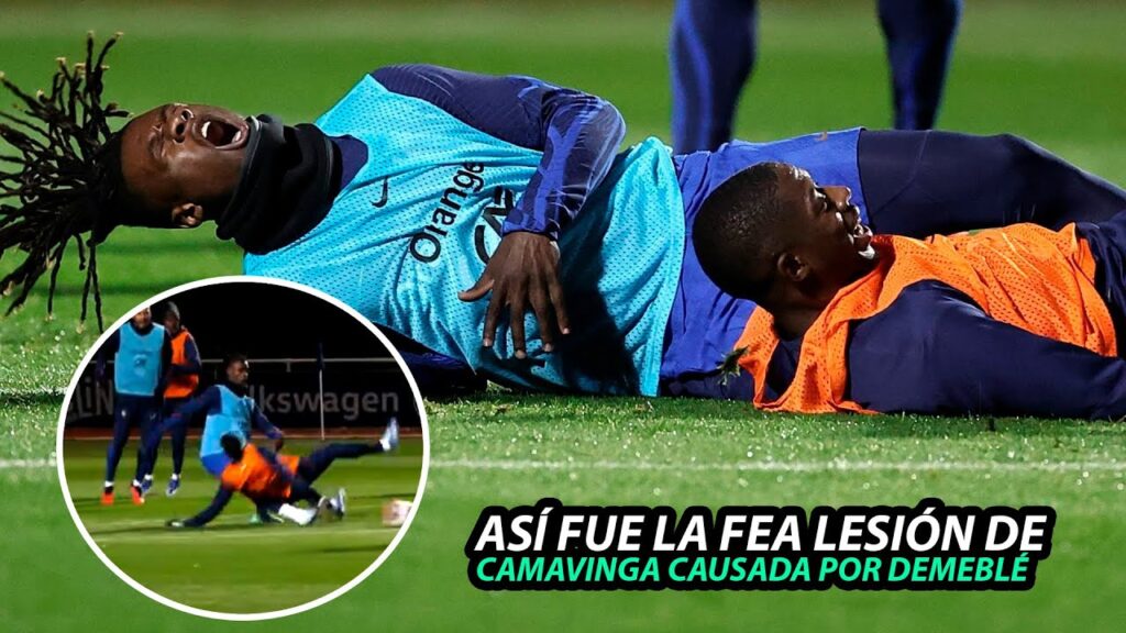 Así FUE el momento EXACTO cuando DEMBELÉ LESIONA a CAMAVINGA en el ENTRENAMIENTO de FRANCIA