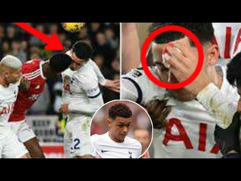 Watch 🔴 Brennan Johnson Nasty Head Injury - Johnson Deep Head Cut - Horror Collision With Willy Boly