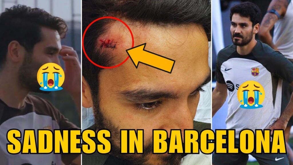 🚨URGENT! BAD INJURY HITS ILKAY GUNDOGAN BEFORE BARCELONA V LAS PALMAS MATCH! BARCELONA NEWS TODAY!