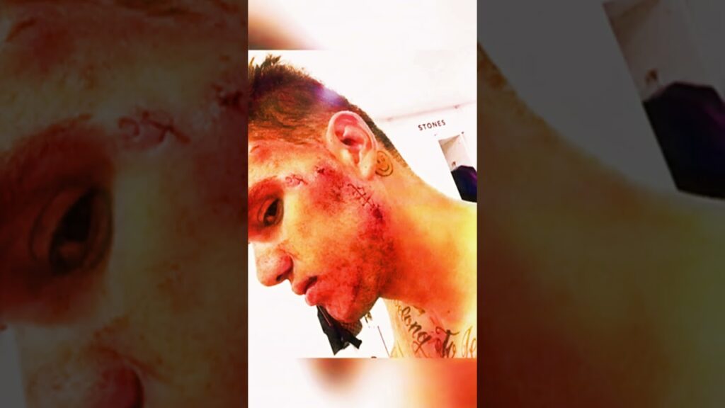 Ederson Revenge - Who do you think is right?