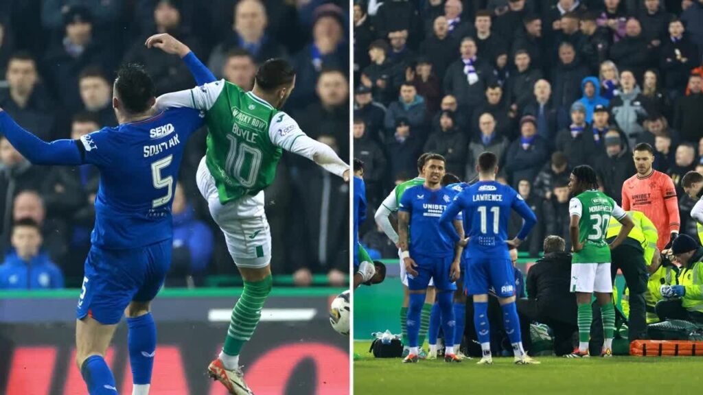 Hibs ace Martin Boyle stretchered off in worrying scenes in cup clash vs Rangers