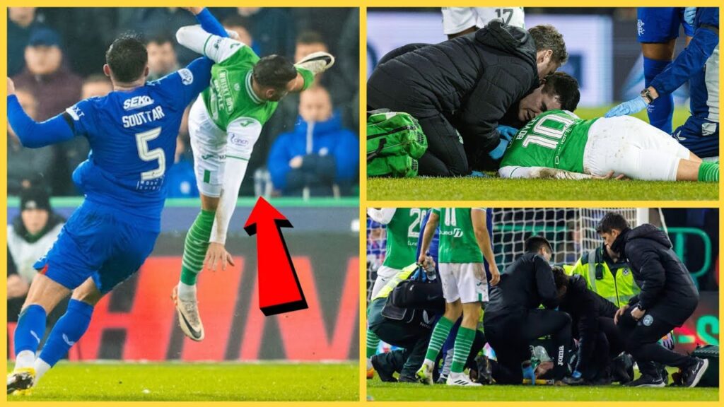 Video 🔴 Martin Boyle Nasty Injury - Hibernian Football star suffers head injury vs Rangers -