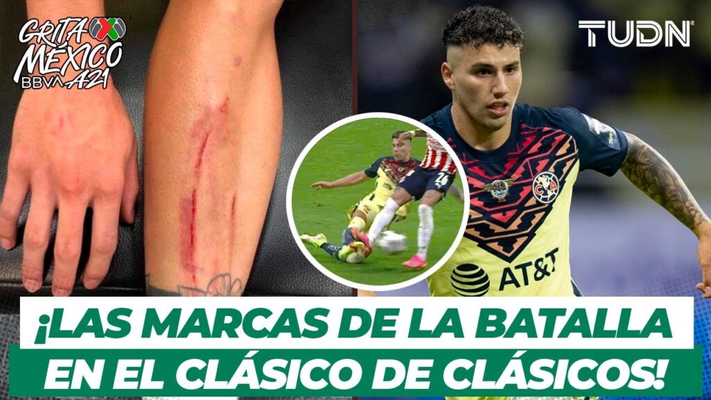 ¡INAUDITO! Jorge Sánchez ‘presume’ las marcas por el pisotón del ‘Chicote’ | TUDN ¡INAUDITO! Jorge Sánchez ‘presume’ las marcas por el pisotón del 'Chicote' | TUDN