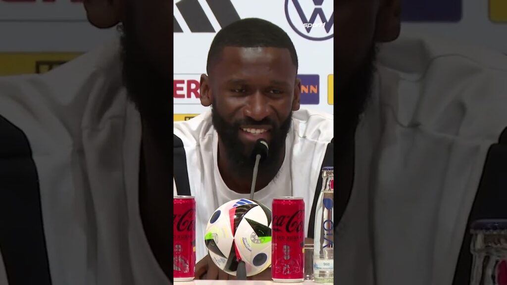 Thomas Müller mit Glatze? 😂 #shorts