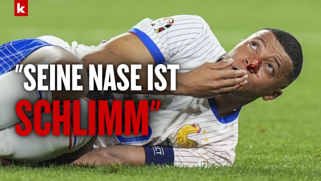 Deschamps über Mbappé: "Es geht ihm nicht gut" I Österreich - Frankreich 0:1