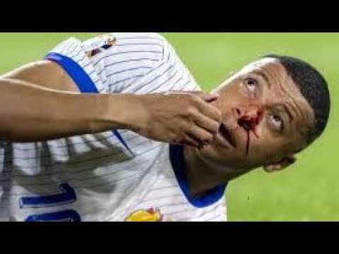 Live : La France N'est Plus Favori (Onip & Miguel)