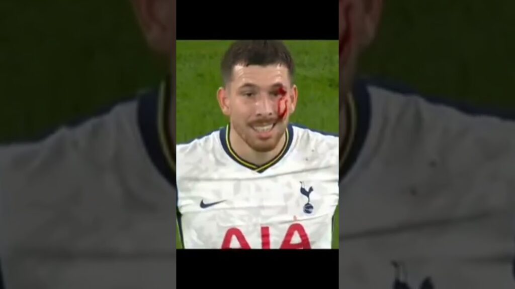 Pierre-Emile Hojbjerg Great Defensive Skills.