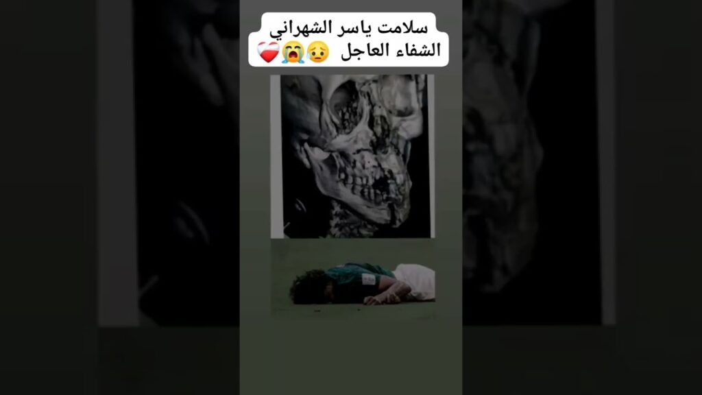 اصابه ياسر الشهراني كادت إن تدي بحيات الاعب   #short