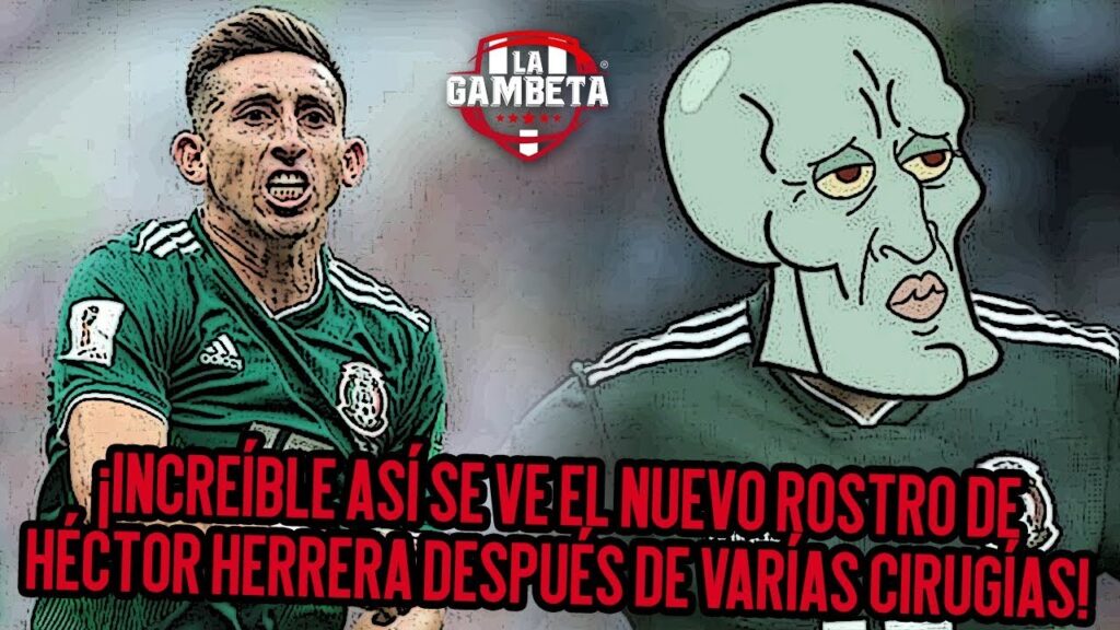 INCREÍBLE así se ve el nuevo rostro de HÉCTOR HERRERA depsués de varias CIRUGRÍAS PLÁSTICAS 🤢🚨😎